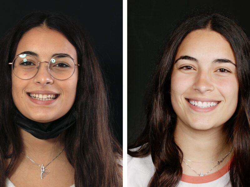 Antes y después de Elisa - Resultados asombrosos en la Clínica Berbís Estela, Clínica dental en Castellón