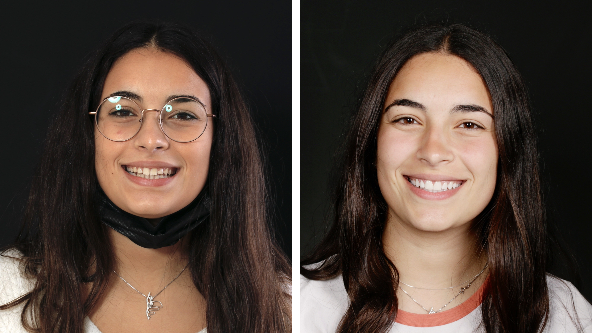 Antes y después de Elisa - Resultados asombrosos en la Clínica Berbís Estela, Clínica dental en Castellón