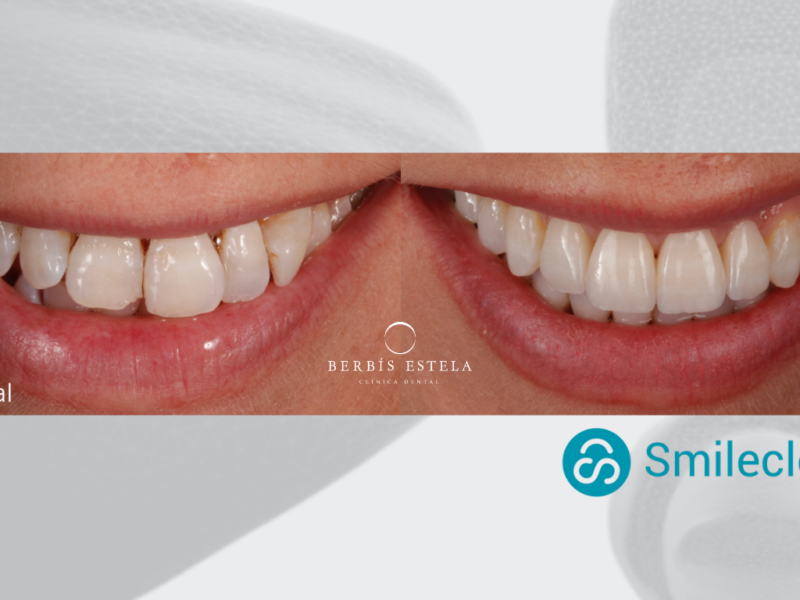 Diseño digital SmileCloud