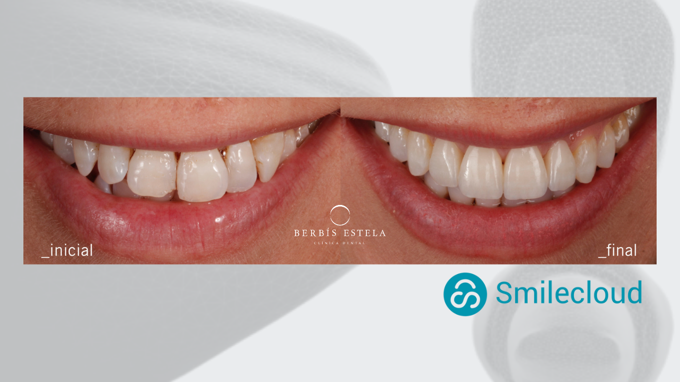 Diseño digital SmileCloud